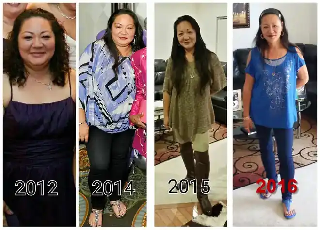 Paula C. — weight-loss progress after bariatric surgery at Virginia Bariatric Center