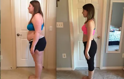 Amanda G. — weight-loss progress after bariatric surgery at Virginia Bariatric Center