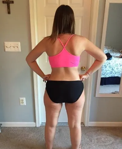 Amanda G. at a later milestone after weight-loss surgery with Dr. Matthew Fitzer