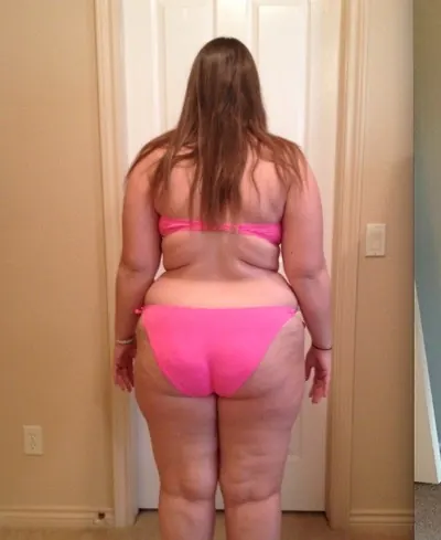 Amanda G. at a later milestone before weight-loss surgery with Dr. Matthew Fitzer