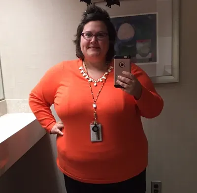 A Halloween-costume transformation before weight-loss surgery with Dr. Matthew Fitzer