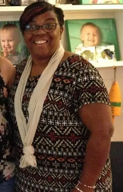 Lorraine W. before weight-loss surgery with Dr. Matthew Fitzer