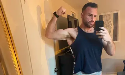 Jason Lamprey after weight-loss surgery with Dr. Matthew Fitzer
