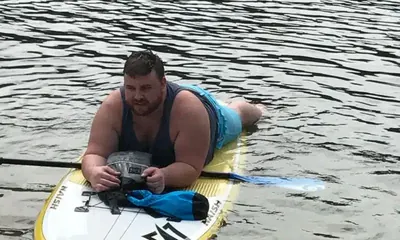 Jason Lamprey before weight-loss surgery with Dr. Matthew Fitzer