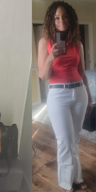 An anonymous head-to-toe transformation after weight-loss surgery with Dr. Matthew Fitzer