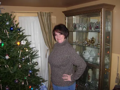 M. M. after weight-loss surgery with Dr. Matthew Fitzer