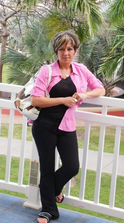 L. S. after weight-loss surgery with Dr. Matthew Fitzer
