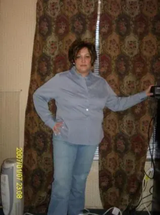 L. S. before weight-loss surgery with Dr. Matthew Fitzer