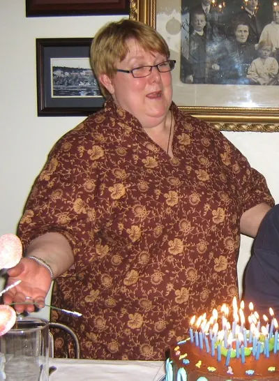 JDB before weight-loss surgery with Dr. Matthew Fitzer