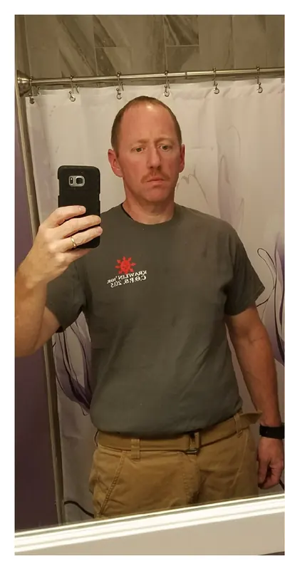 Chad Beckhert after weight-loss surgery with Dr. Matthew Fitzer