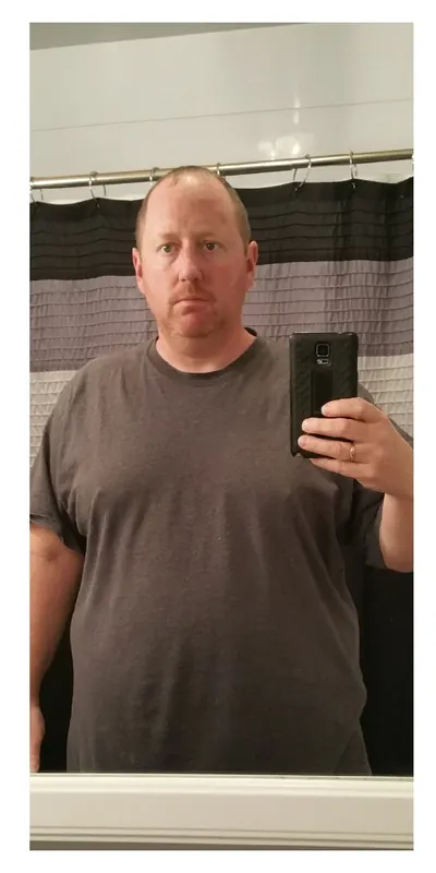 Chad Beckhert before weight-loss surgery with Dr. Matthew Fitzer