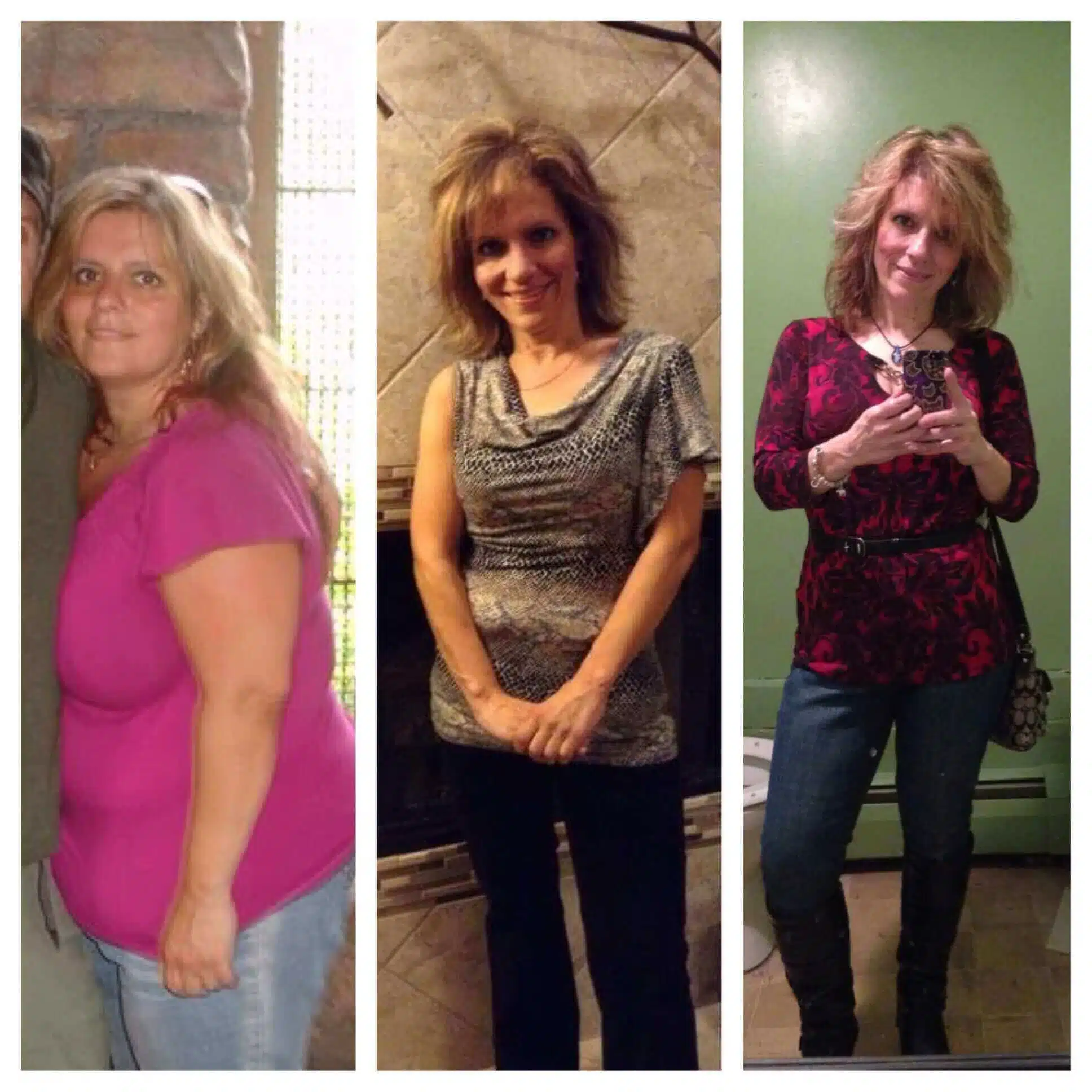Before and after weight loss from bariatric surgery